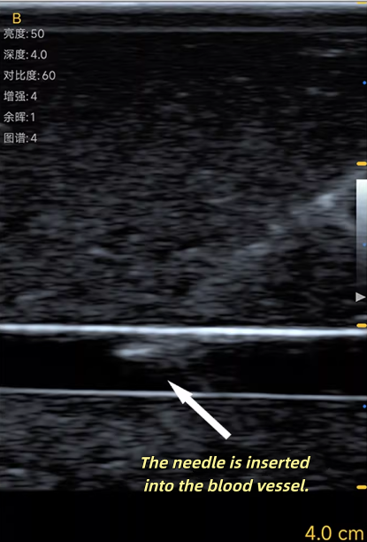Model do treningu punkcji nacz – Medical Gel Ultrasound recenzja i cena